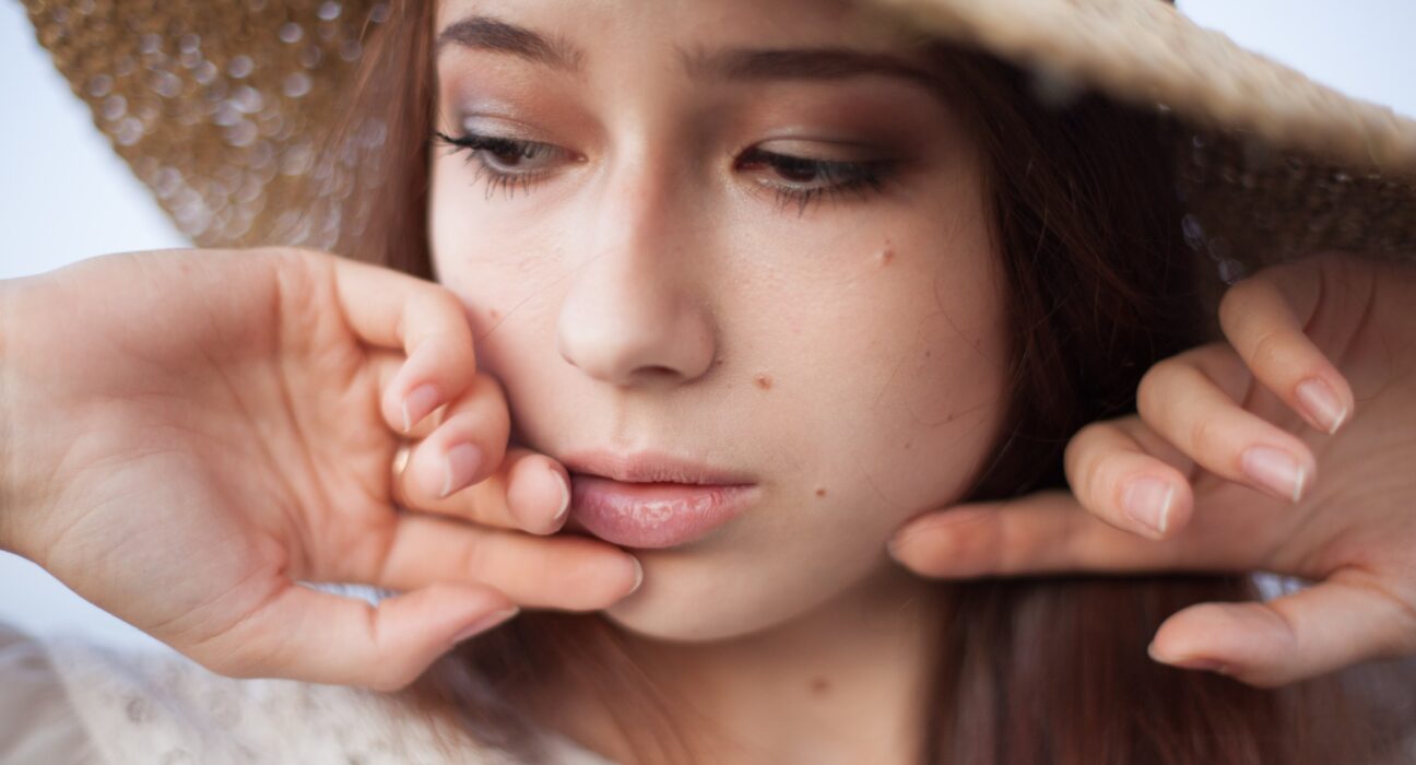 Acnee la adolescenți. Cauze, remedii și cele mai bune tratamente naturale 1 close up young woman hat